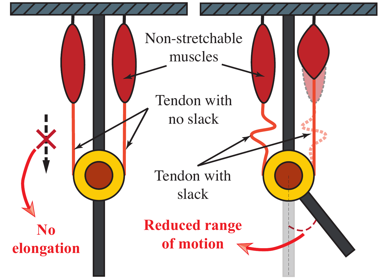 Concept diagram showing no elongation for taut non-stretchable muscles and reduced range of motion when slack tendons are used